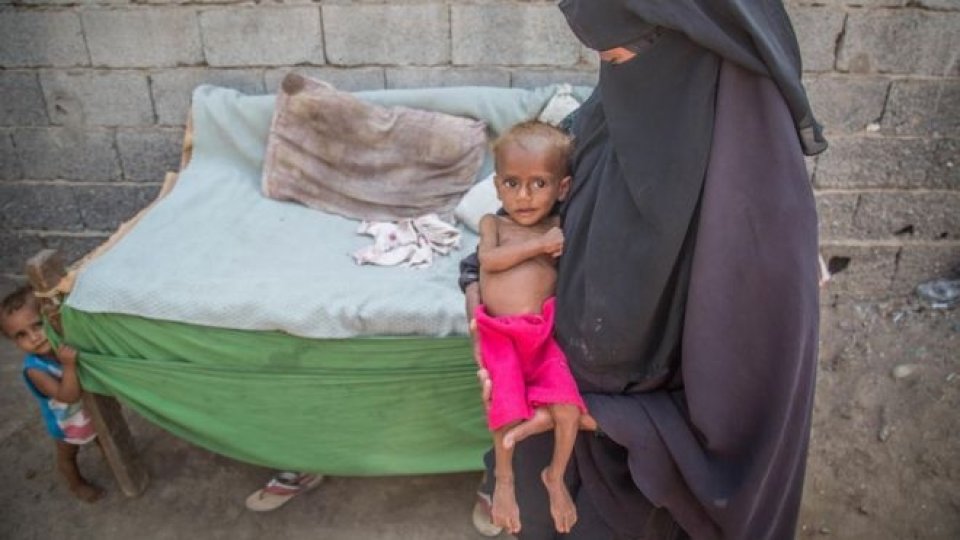 Yemen: ethah million bayaku bandah maruvuma emme fiyavalheh dhurugai!