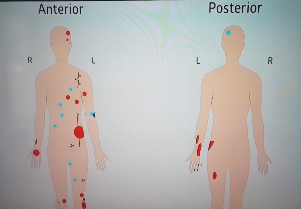 Nasheedge hippulhah dagandhukolheh nuheri huree centimeter eh: ADK