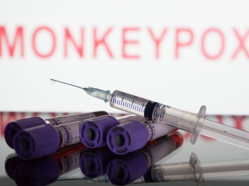 Vaccine akun ekani monkeypox eh nuhuttuvayne: WHO