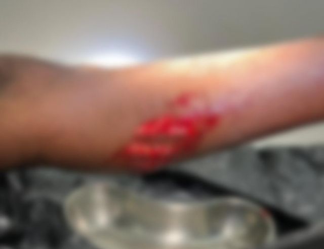 Mahah nikume ulhunu Foakaidhoo meehakah miyareh hamalaadheefi, fayah bodu zahameh! 