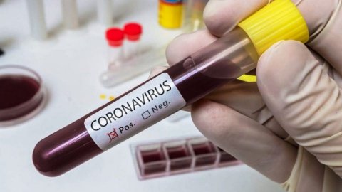 5 more tests positive for Covid-19
