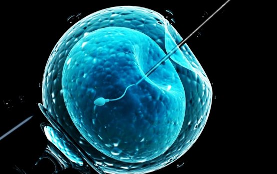 IVF hedheyne ehmme mathee umurakee 42 aharu kamah kanda alhaifi