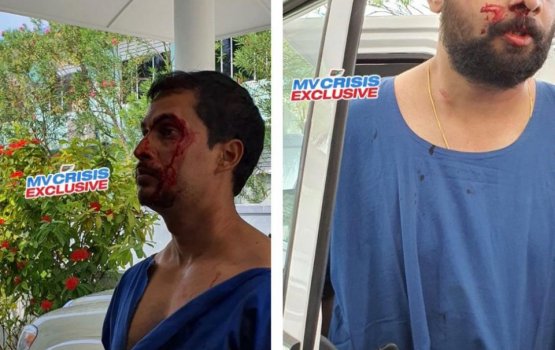 Muli Hospital doctors brawl resulting in injuries