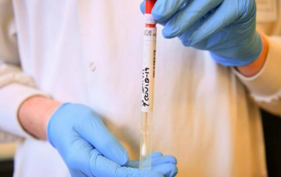 COVID19: Another 30 tests positive for the virus in Maldives