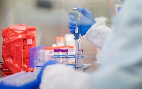 HPA reports 25 new cases of COVID-19 on friday