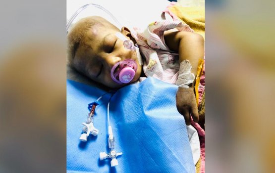 Saaraa: 7 gadi iruge operation akah fahu tumor ge ehbai nagaifi