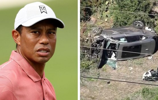 Accident ve, Tiger Woods ah serious aniya thakeh!
