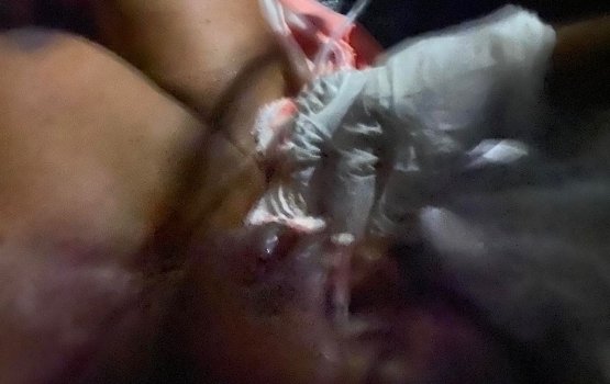 Dinghy accident victim fighting for his life: Family