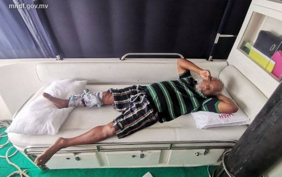 Man bitten by a shark after falling off a fishing vessel