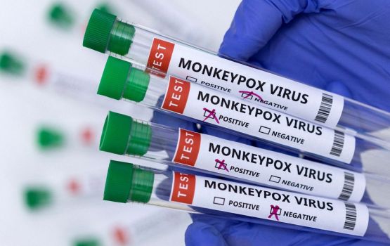 Thailand inn vess monekypox fenijje, ekamaku patient gellijje