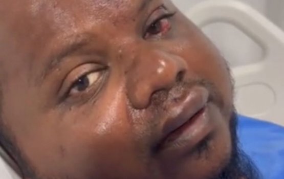 Dhiffushi Mob Violence: A harrowing account of vigilante justice