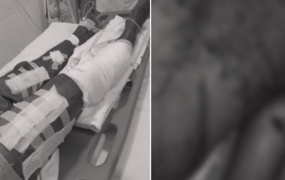 Local man injured in propeller accident