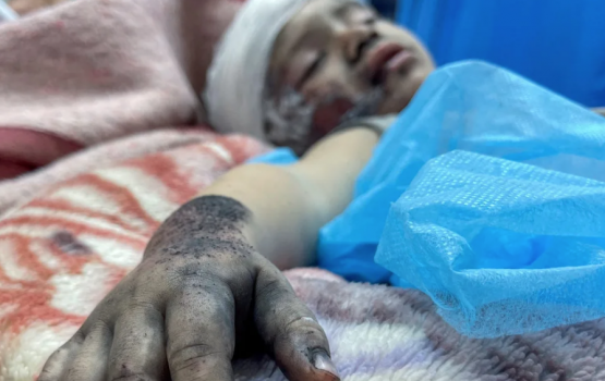 Gaza Hospital gai ventilator gai thi kudhin gendhiumakee maruge adhabeh: Doctor