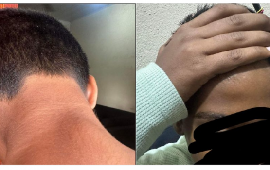 4 children assaulted child at Huvadhoo school