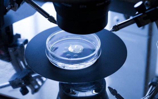 135 couples apply for IVF help, only 39 eligible